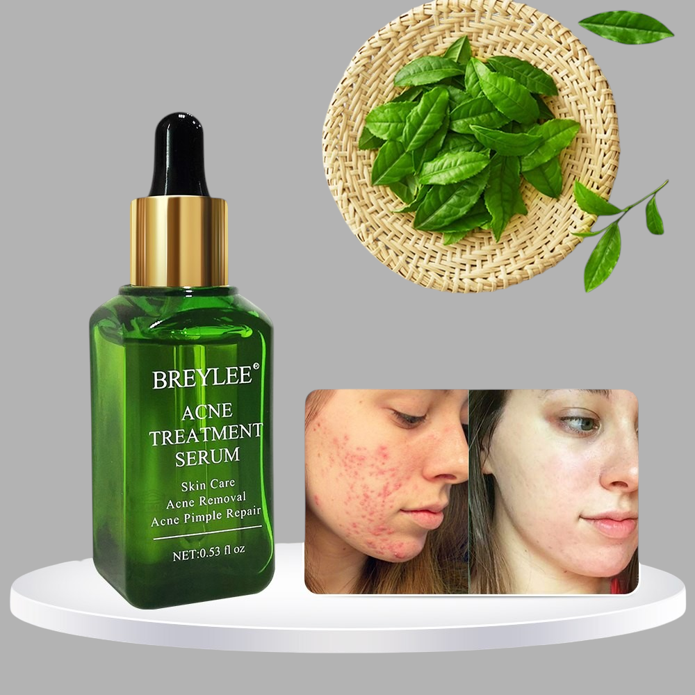 Melia LLC BREYLEE acne treatment serum in a green glass bottle with dropper, featuring tea leaves and before-after skin